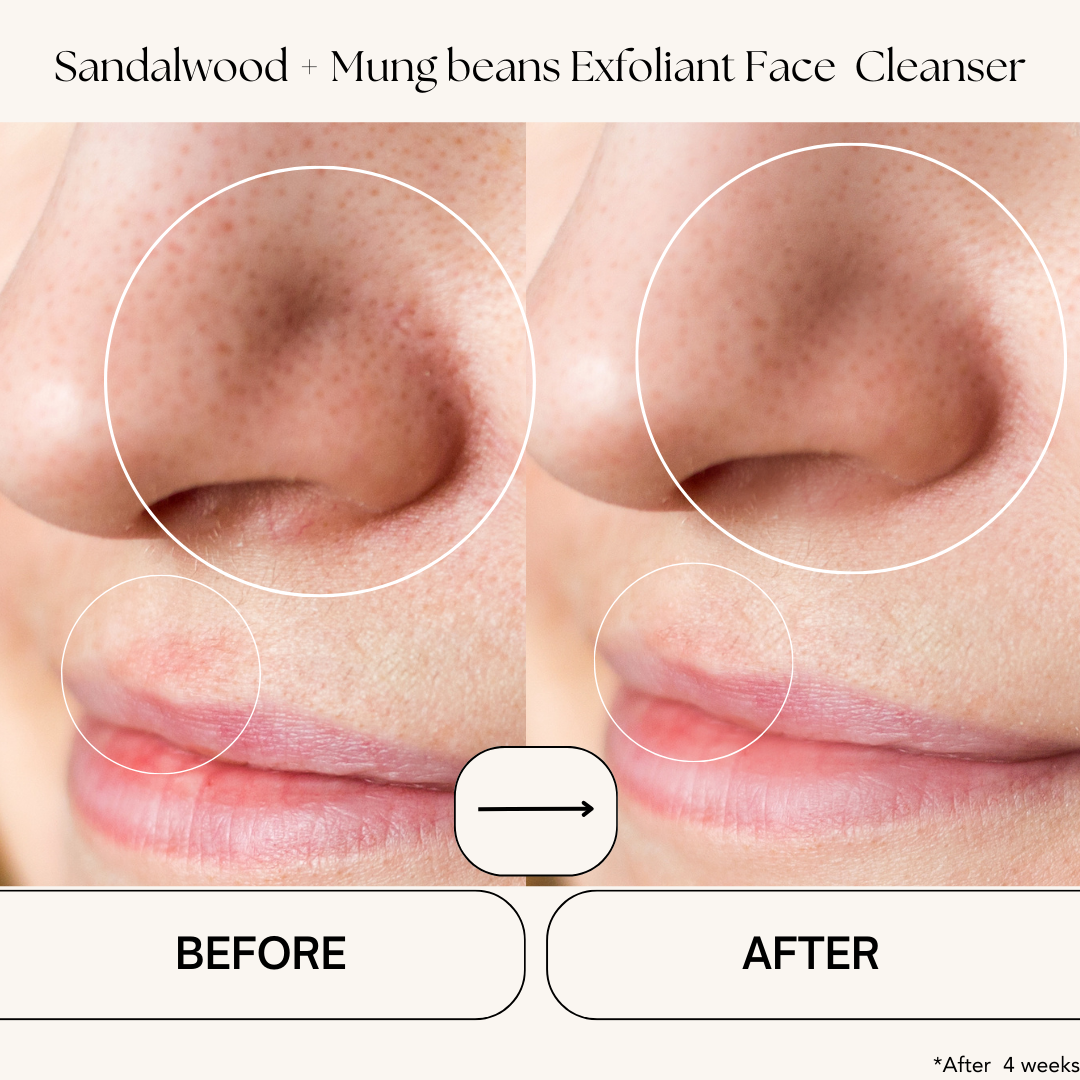 Sandalwood + Mung Beans Exfoliating Face Cleanser (Dry to Normal Skin)