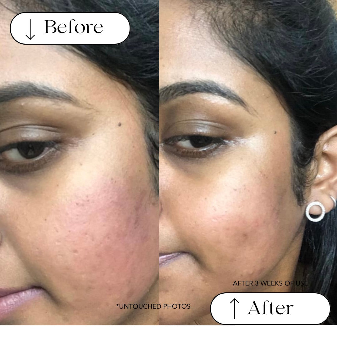 Turmeric + Rose Anti-inflammatory Facial Cleanser (Oily to Normal Skin)