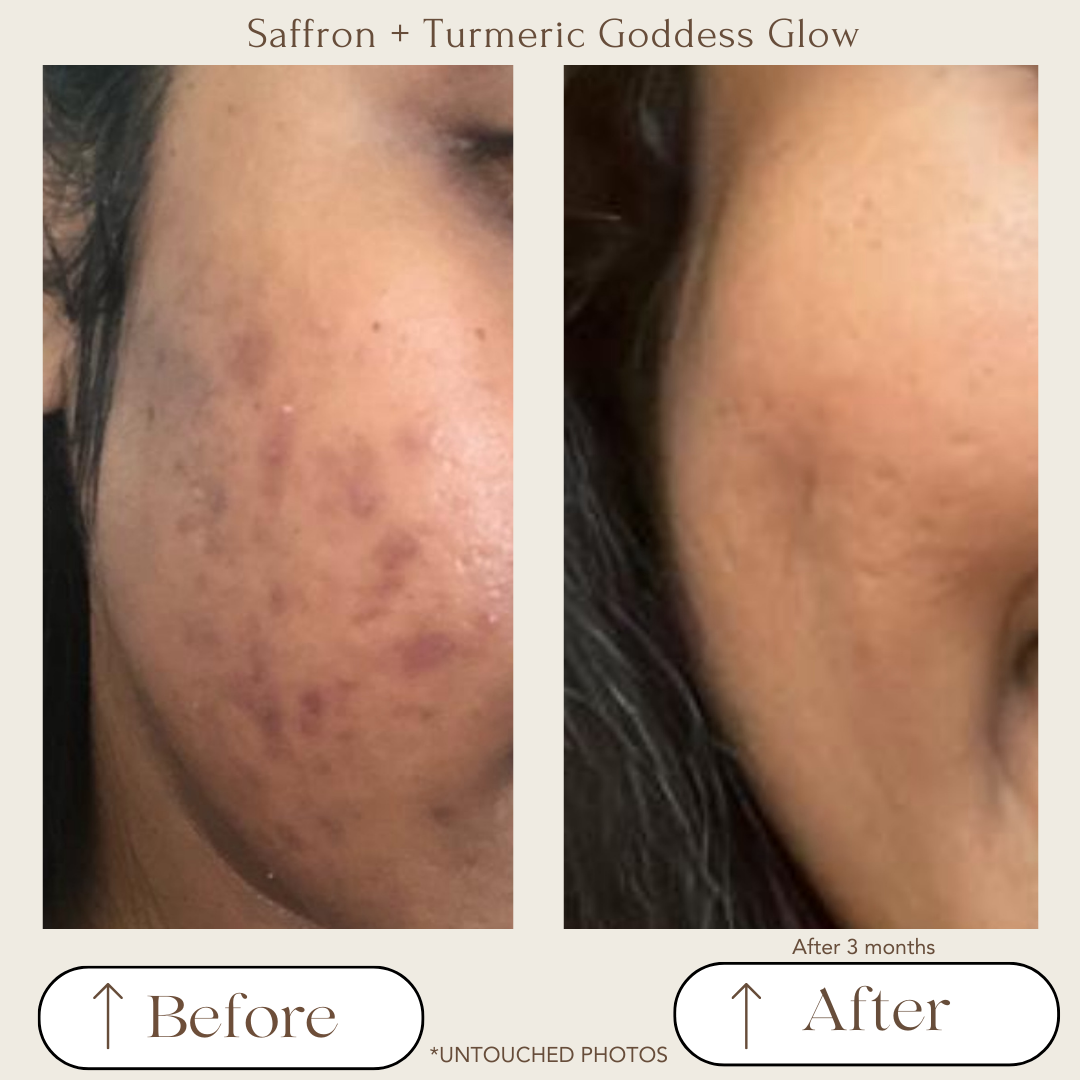 Saffron + Turmeric Goddess Glow Face Mask for Dark spots and Blemishes
